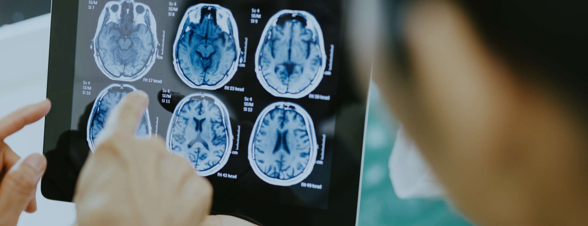 A close-up image of a person examining brain MRI scans displayed on a tablet, highlighting neurological diagnostics and medical analysis.